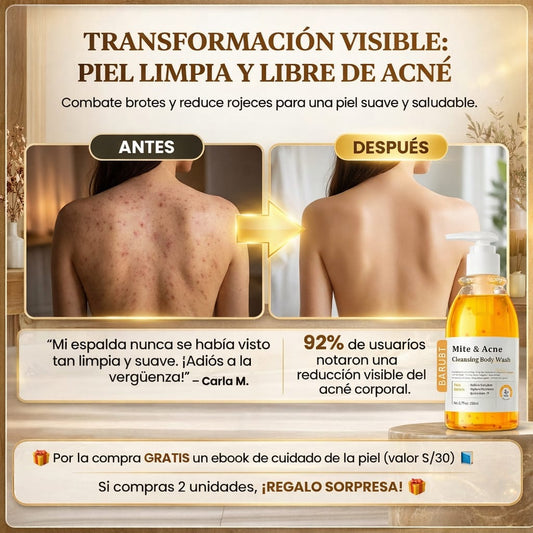 Mite & Acne Cleansing Body Wash